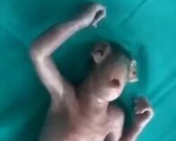Baby born mutated