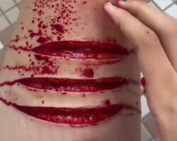 Deep cuts in thigh and squirting blood