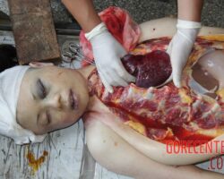 Autopsy of Chinese girl