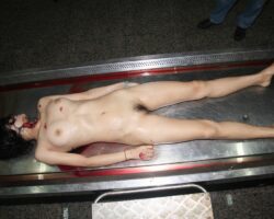 Autopsy of Chinese woman with slit throat