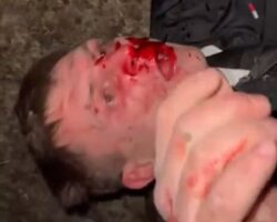 Beaten unconscious and then beaten back to consciousness