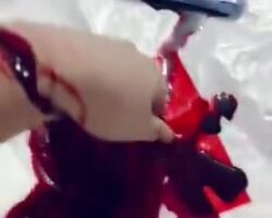 Blood oozing from cut on her arm