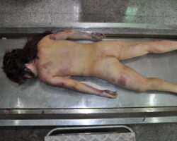 Chinese woman in morgue #22
