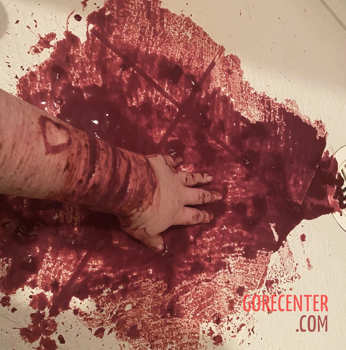 Deep cut on girl's arm • GoreCenter
