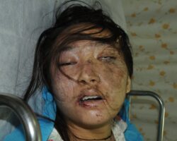 Dead chinese woman