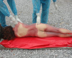 Examination of hanged Chinese woman