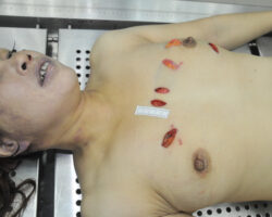 Examination of stabbed Chinese woman #2