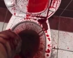 Fountain of blood from wrist