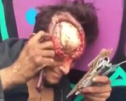 Psycho dude cuts flesh from his skull