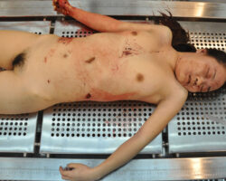 Stabbed Chinese girl in morgue
