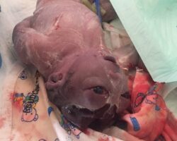 Baby born mutated #2