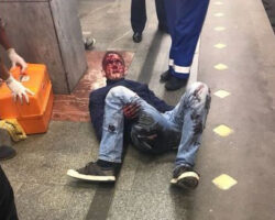 Dude miraculously survived jumping in front of subway train