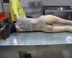 Examination and autopsy of skinny tattooed Chinese woman