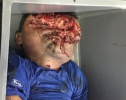 Head crushed by hydraulic press