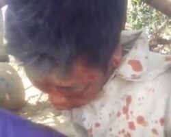 Inhumane torture of Myanmar rebel