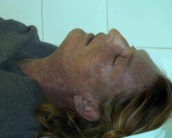Dead woman in morgue