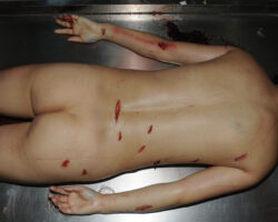 Stabbed Chinese woman in morgue