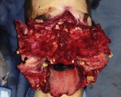 Guy survived suicide attempt