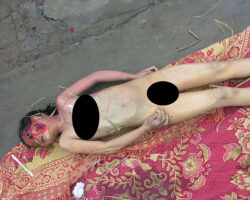 Young girl died in forest, face partially eaten