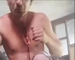 Accident with chainsaw