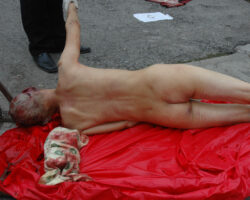 Examination and autopsy of Chinese woman with skull fracture