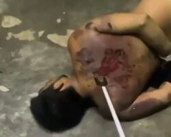 Torturing hostages with electricity