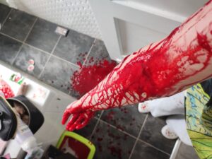 Self-harm