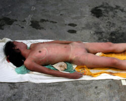 Examination of dead Chinese woman
