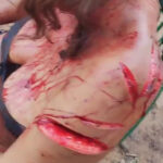 Dude injured his mother with machete after argument over lost cat