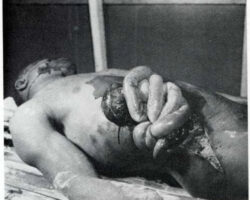 MIX: Victims of World War II #2