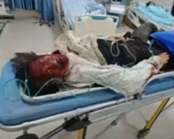 Chinese girl got burnt by throwing fireworks in the sewer well