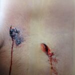 Her stab wounds
