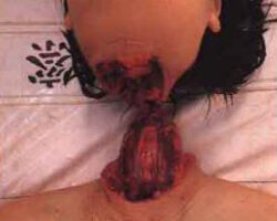 Japanese woman nearly tore her head off in suicide jump