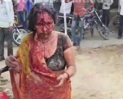 Woman bloodied by abusive husband seeks help in streets