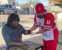 Homeless man lost his hand in machete fight