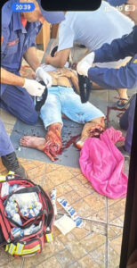 Motorcyclist has both legs destroyed after collision with car