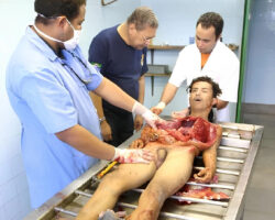 18-year-old thug ended up in morgue