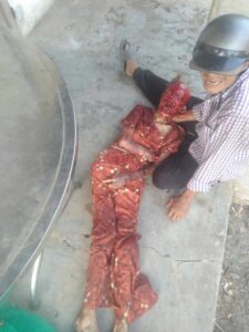 89-year-old woman torn mauled by stray dogs