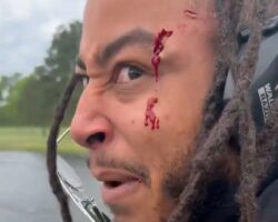 Bloody injured while doing stupid things with weapon