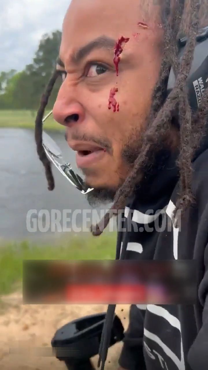 Bloody injured while doing stupid things with weapon • GoreCenter