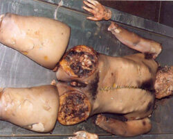Completely dismembered woman in morgue