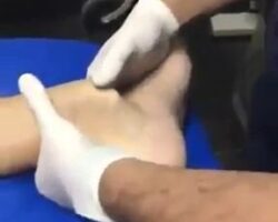 Doctor is putting bone in ankle back in its place