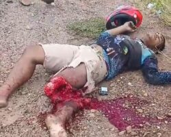 Guy tore off his leg in motorcycle crash