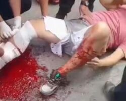 Guy was run over by truck while crossing road