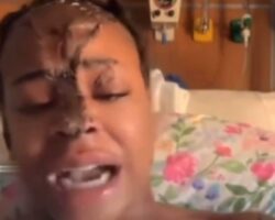 Her sister poured acid on her face