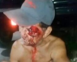 Homeless man after being jumped on street