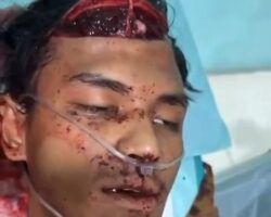 Man was slashed in head during fight