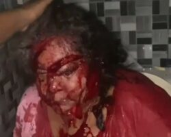 Mutilated woman after machete attack