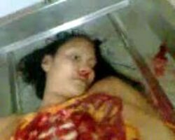 Open corpse of woman in Mexican morgue