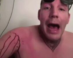TikToker is stabbing himself with knife on live stream